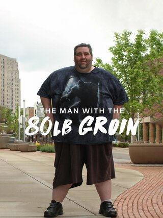 The Man with the 80lb Groin